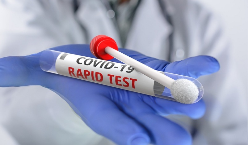 MoPH Bans Conducting COVID-19 Rapid Tests in Pharmacies